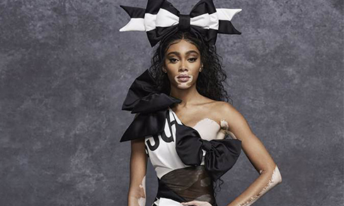 Moschino partners with Winnie Harlow on pre-fall 2021 campaign